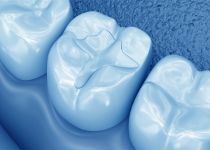 Angstpatienten Zahnarzt Spandau